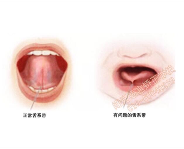 大舌头